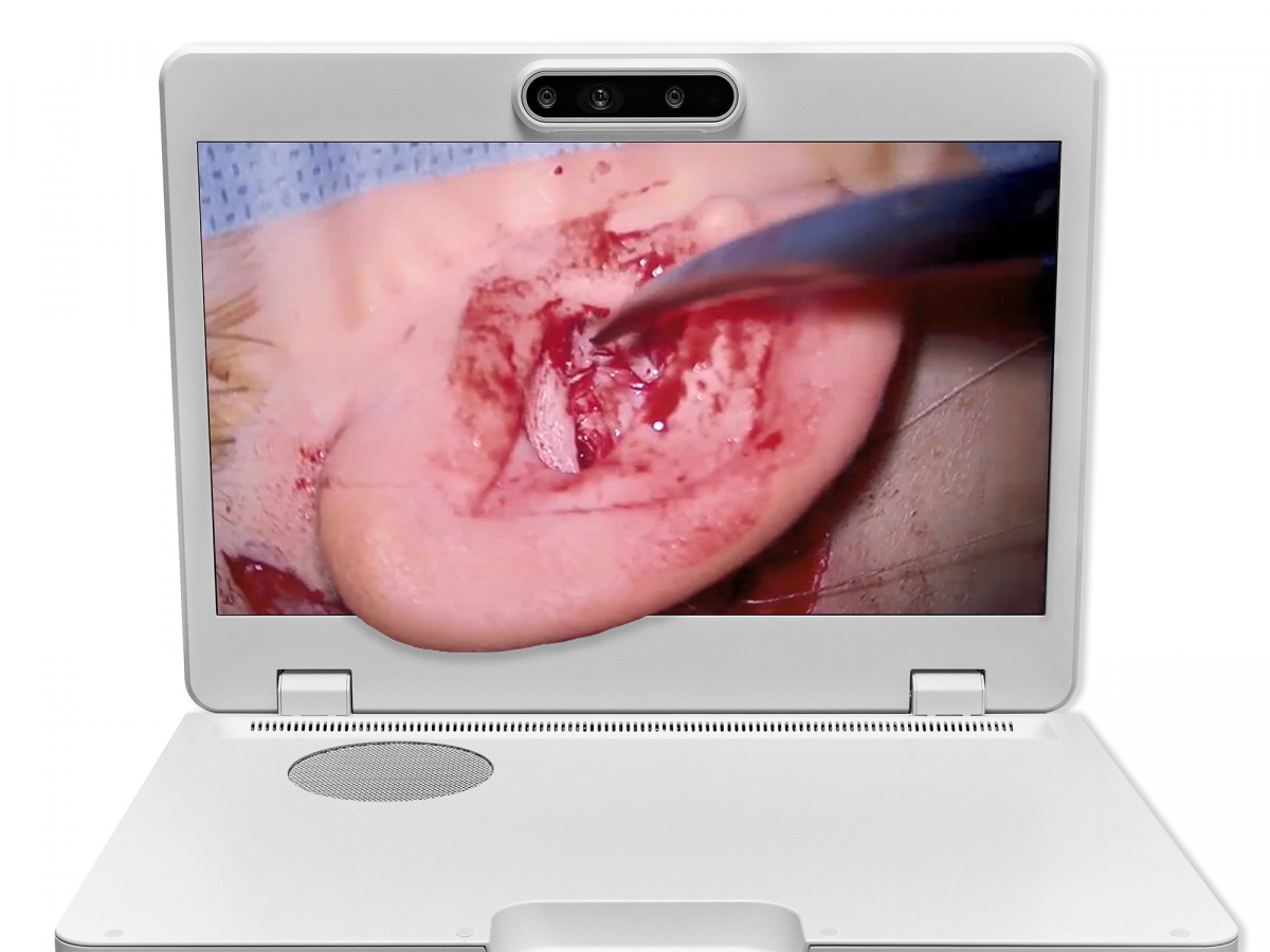 达擎之＂Heads-up 3D显微手术显示系统＂，整合4K裸眼3D显示及眼球追踪系统，具备快速追踪人眼移动位置功能，减轻医师长时间维持固定姿势的负担，让医师能有更宽广清晰的3D立体视野及更舒适的姿势来执行手术。